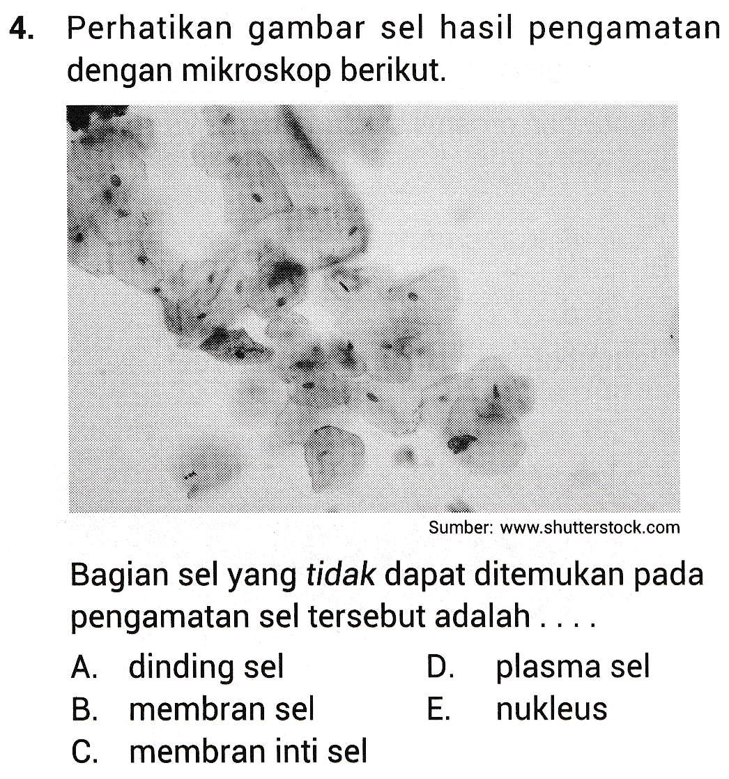 4. Perhatikan gambar sel hasil pengamatan dengan mikroskop berikut. Sumber: www.shutterstock.com Bagian sel yang tidak dapat ditemukan pada pengamatan sel tersebut adalah .... A. dinding sel D. plasma sel B. membran sel E. nukleus C. membran inti sel 
