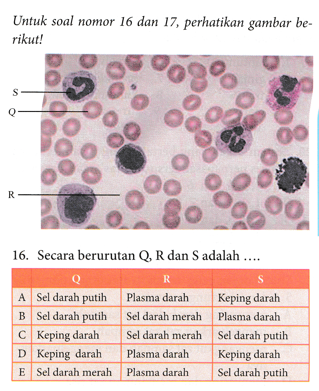 Untuk soal nomor 16 dan 17, perhatikan gambar be- rikut! od S PO R o 8 od 16. Secara berurutan Q, R dan S adalah .... R S Plasma darah Keping darah Sel darah merah Plasma darah A Sel darah putih B Sel darah putih C Keping darah D Keping darah E Sel darah merah Sel darah merah Sel darah putih Plasma darah Keping darah Plasma darah Sel darah putih 